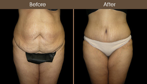 20202705143707_B2-Front